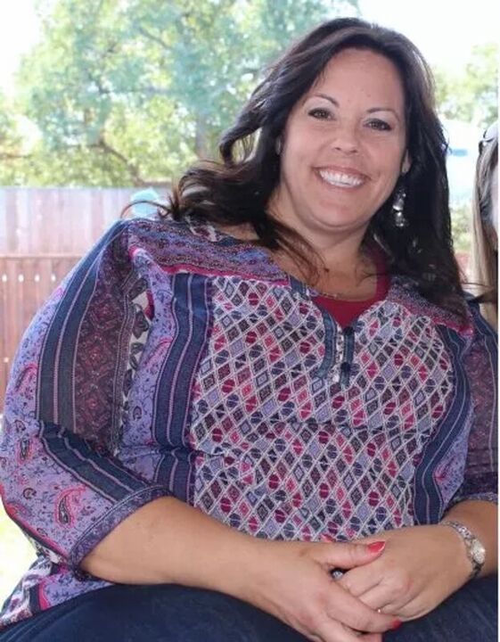 Obesity before ketocaffe